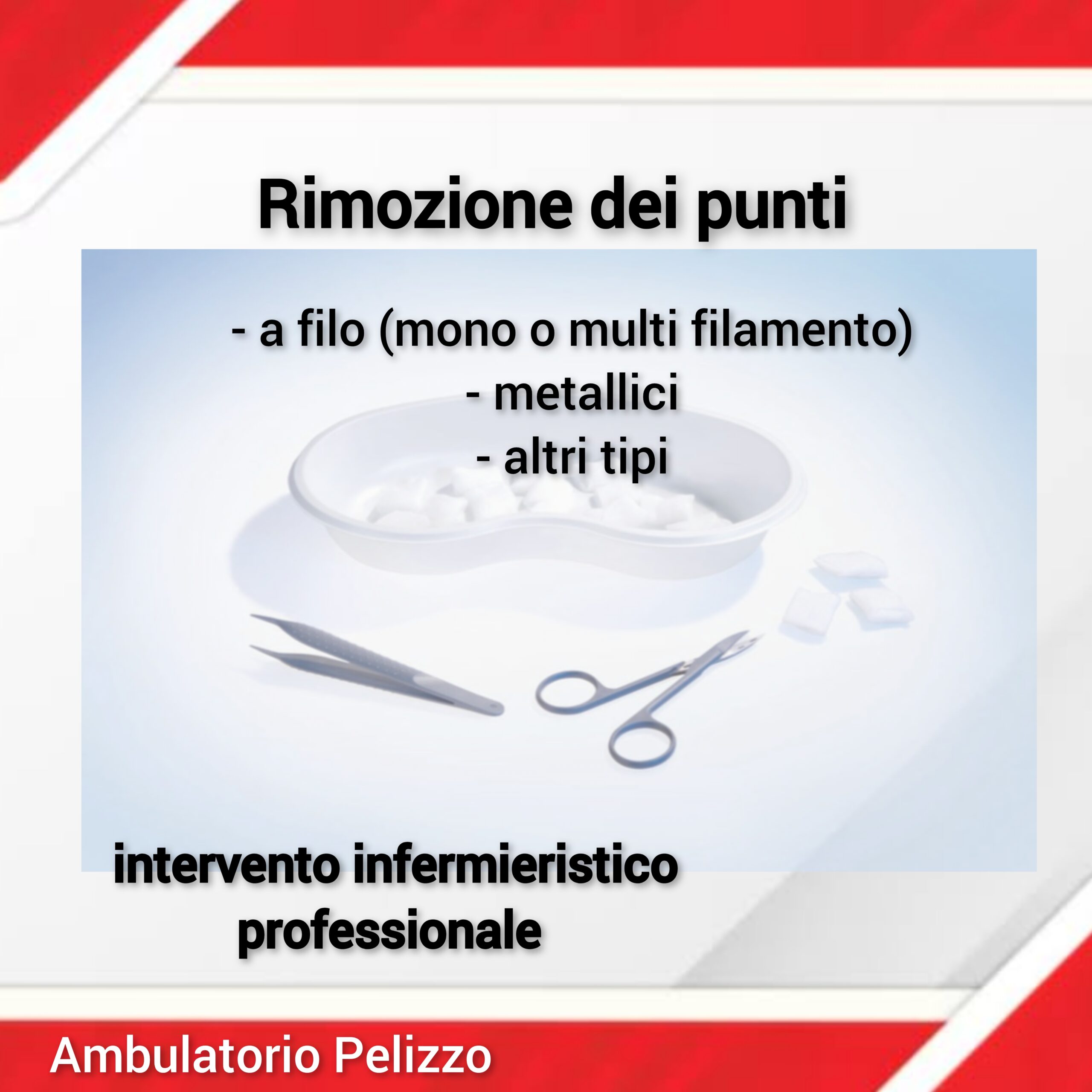 la rimozione dei punti con intervento infermieristico